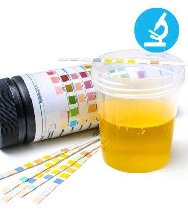 Sediment und Urindiagnostik (ZH)